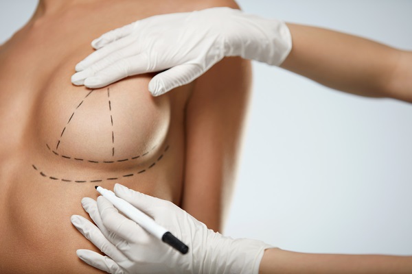 Breast Implant Incision Care at Home