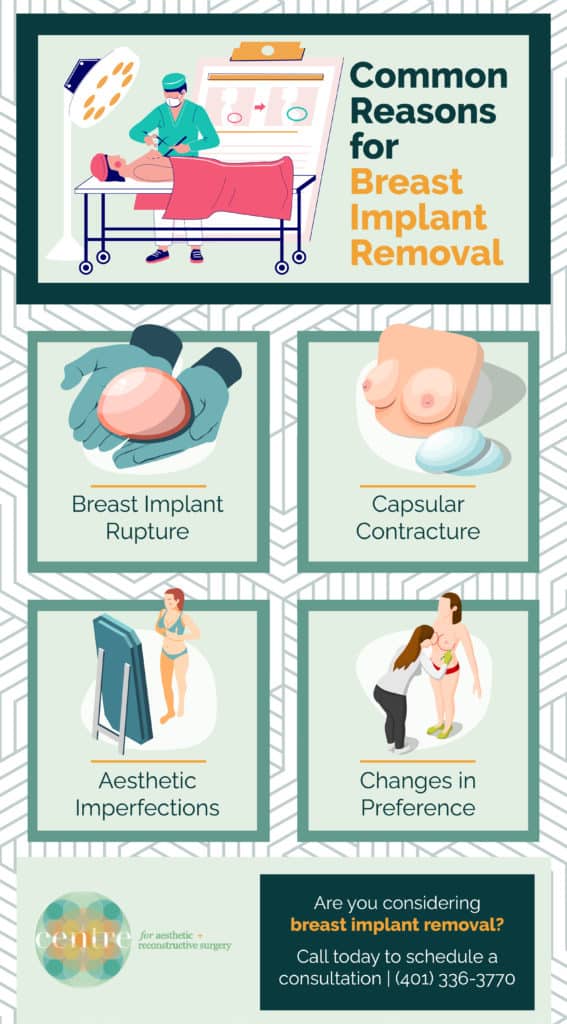 The Top Reasons for Breast Explant Surgery