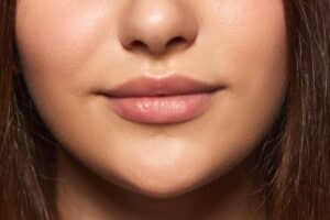 Closeup of woman’s naturally pouty mouth after lip flip BOTOX treatment.